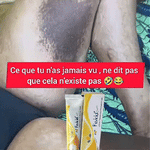 Charger l&#39;image dans la galerie, Fevicid Crème – Anti-Mycoses, Tâches Noires et Boutons de Rasage
