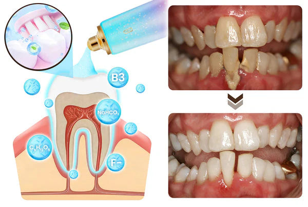 Dentifrice au Niacinamide - Souriez en toute confiance