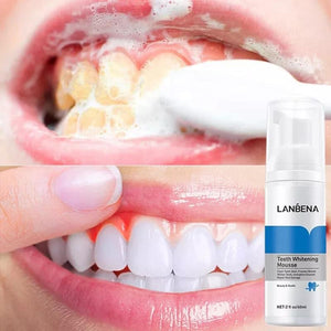 Mousse de blanchiment  dentaires LANBENA