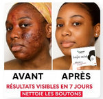 Charger l'image dans la galerie, 🧼Packt Savons Kojic –Purifie, Nettoie et Illumine Visiblement la Peau
