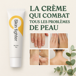Charger l'image dans la galerie, Skin Fighter – La Crème Qui Combat Tous  démangeaisons, rougeurs, mycoses et irritations !
