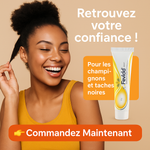 Charger l'image dans la galerie, Fevicid Crème – Anti-Mycoses, Tâches Noires , Entre Jambe Noire, et Boutons de Rasage
