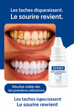 Charger l'image dans la galerie, EFERO™ – Essence Blanchissante Ultra-Puissante | Élimine Tartre &amp; Taches en Quelques Jours
