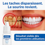 Charger l'image dans la galerie, EFERO™ – Essence Blanchissante Ultra-Puissante | Élimine Tartre &amp; Taches en Quelques Jours
