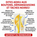 Charger l'image dans la galerie, Fevicid Crème – Anti-Mycoses, Tâches Noires , Entre Jambe Noire, et Boutons de Rasage
