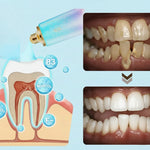 Charger l'image dans la galerie, fini les dents jaunes, la mauvaise haleine et les taches qui gâchent votre sourire

