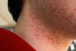 Charger l'image dans la galerie, Skin Fighter – La Crème Qui Combat Tous  démangeaisons, rougeurs, mycoses et irritations !
